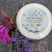 Load image into Gallery viewer, Skin Bee Happy - Dry Skin - Eczema Relief - Stretch Mark Salve